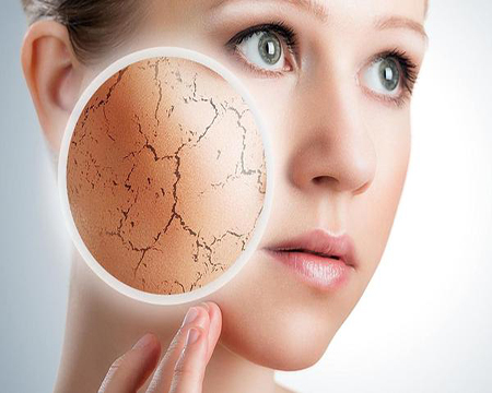 化學洗面乳造成敏感肌