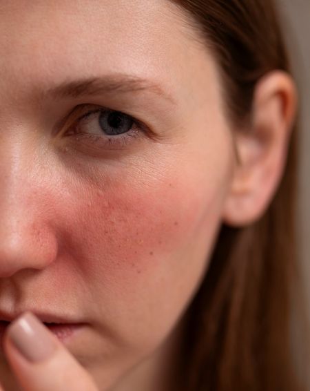 Ang pagkumpuni ng hadlang, anti-inflammation, at katatagan ay nagiging mas mahalaga kaysa sa agarang sensasyon.