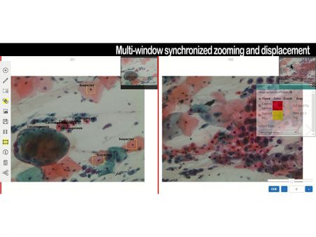 Multi-window synchronized zooming and displacement.