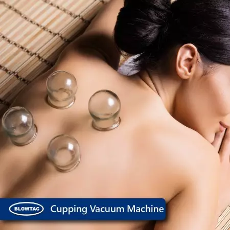 Máy hút chân không cupping