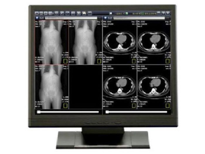Clinical Medical Display Monitor | Top-Quality Medical Monitors & All ...