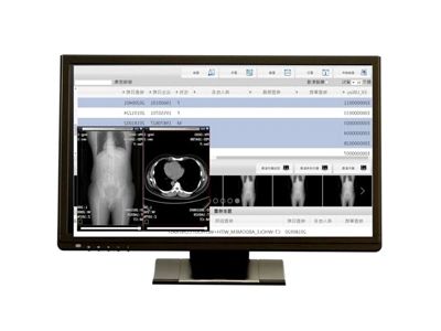 Monitor chirurgico ad alta definizione completa e PC medico