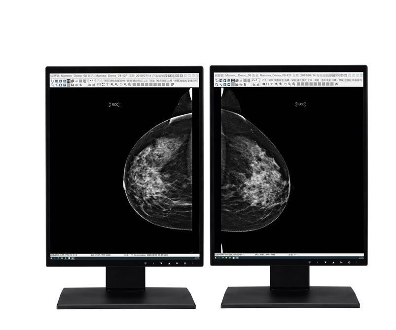 Pantalla médica certificada EN60601 con cumplimiento de DICOM 3.14 Parte 14 GSDF