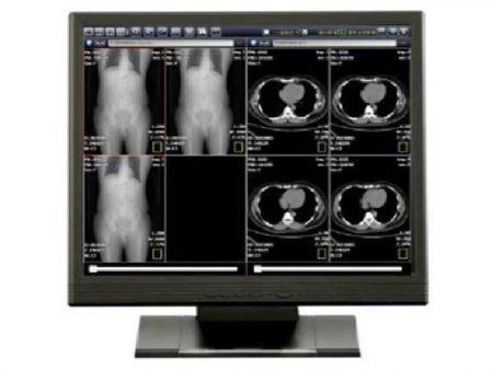 Monitor de visualización médica clínica - Monitor médico clínico de 19 pulgadas full HD compatible con DICOM
