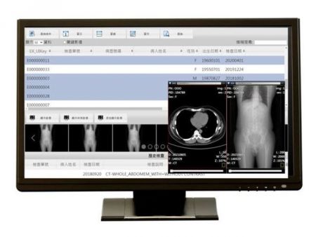 Monitor Clínico Médico de 23,8 polegadas com alta luminosidade e certificado EN60601