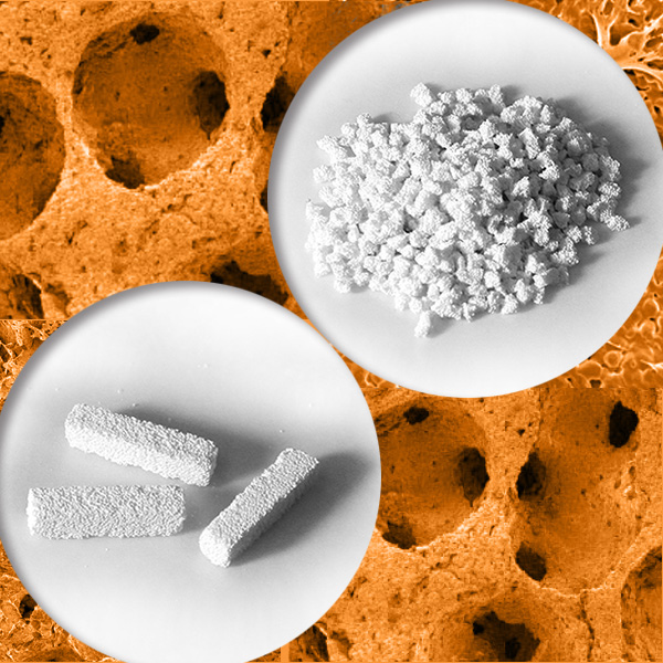 Substitut de greffe osseuse Osteocera™ - Greffe osseuse Ostéocésien