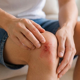 Pele - Proteção excelente e duradoura para a pele