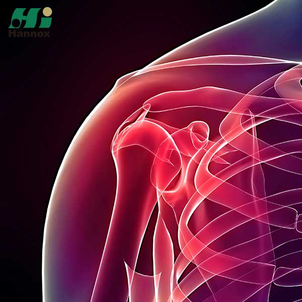 منتجات تقويم العظام - جراحة العظام