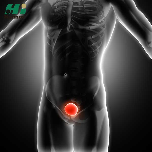 منتجات المسالك البولية - طب المسالك البولية