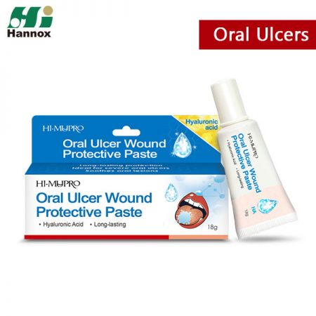 Schutzpaste gegen Mundgeschwüre (Hyaluronsäure-Formel) - Schutzpaste gegen Mundgeschwüre