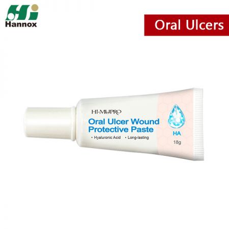 Schutzpaste gegen Mundgeschwüre (Hyaluronsäure-Formel)
