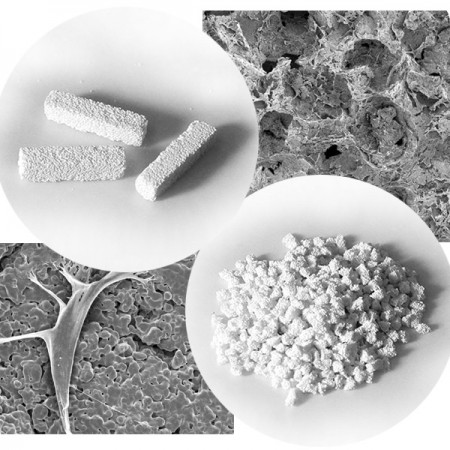 Костная трансплантация