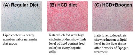 Liver lipid level