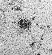 Exossomos isolados de algas, particularmente microalgas, apresentam vantagens únicas tanto em sustentabilidade quanto em versatilidade. Essas nanovesículas são biocompatíveis, ecológicas e repletas de moléculas bioativas, incluindo proteínas, fatores de crescimento, lipídios e componentes de ácido ribonucleico (RNA) de suas células parentais. Exossomos derivados de algas têm propriedades únicas que os tornam bem adequados para aplicações terapêuticas e biotecnológicas. Arquivo de foto: "Microscópio Eletrônico de Exossomos de Microalgas" tirado pela Febico Corporação Biomédica. © 2025 Todos os direitos reservados.