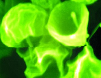 It allows chlorella cell wall to be broken within 3 seconds with many pores on the surface. The idea is similar to the process of popcorn.