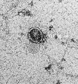 Photo taken under electronic microscope indicates the integrity of microalgae extracellular vesicle after extraction.These precision-engineered vesicles are encapsulated in a natural lipid bilayer, enabling them to bypass the skin barrier and deliver active compounds directly into the deeper dermal layers.