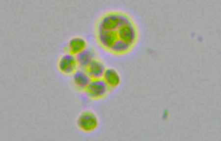 Algae are a diverse group of photosynthetic organisms ranging from unicellular microalgae to large seaweeds. Algae have recently gained attention as a promising source for extracellular vesicle production, thanks to their rapid growth rate—at least 10 times faster than terrestrial plants—and their ability to produce an equivalent amount of biomass using significantly less land area. 