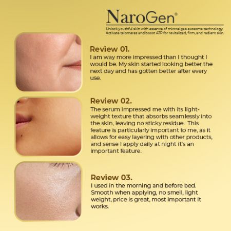 ดูความคิดเห็นจริงจากผู้ใช้ของ Narogen® เอ็กโซโซมไมโครอัลจี.